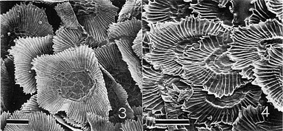 Tricomi peltati di Tillansia baileyi e T.pseudobaileyi. Immagine modificata da Journal of the Bromeliad Society, Volume XXXVI