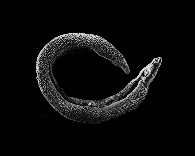 Schistosoma mansoni, un platelminte parassita di pochi centimetri. Immagine Wikimedia Commons